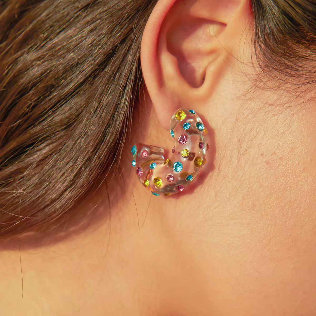 ARETES CIRCONITAS