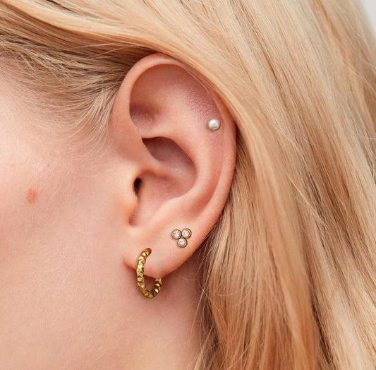 SET ARETES PERLIN